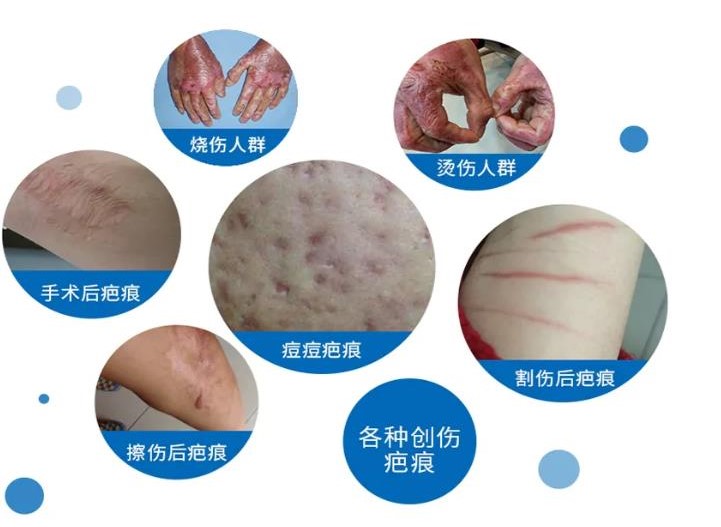 盐城疤痕修复好的医院排名