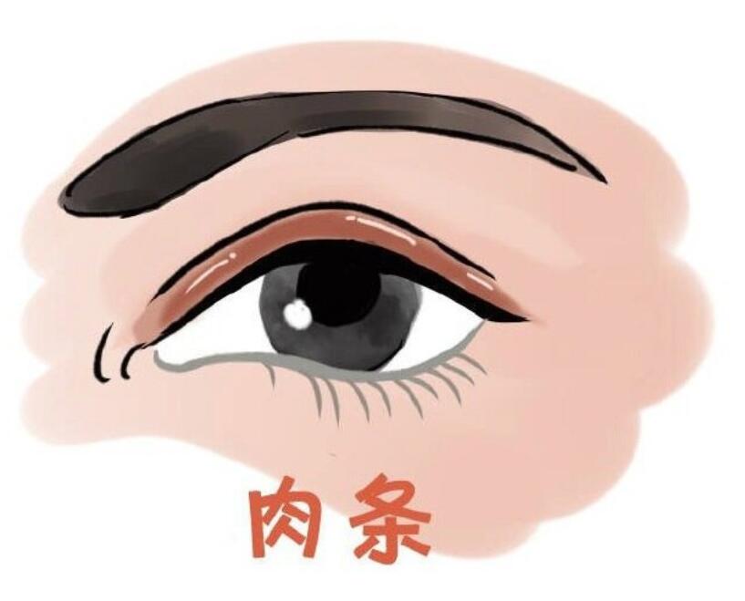 武汉同济医院陈平肉条双眼皮修复好