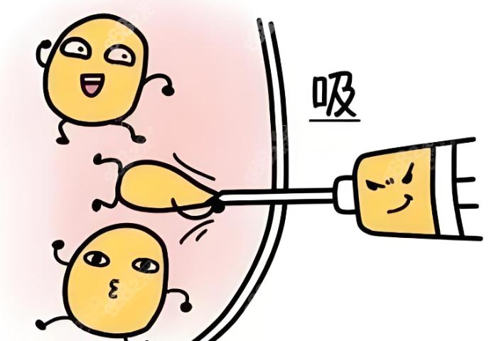 重庆吸脂医生唐国强