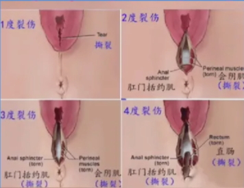 今年全新广州私密修复医院排名：省妇幼/曙光/紫馨等5家正规机构实力解析