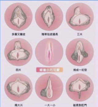 私密修复