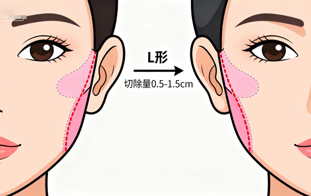 穆宝安坐诊的医院叫什么?北京加减美,地址在平安里西大街,他做v美减龄拉皮提升有一套