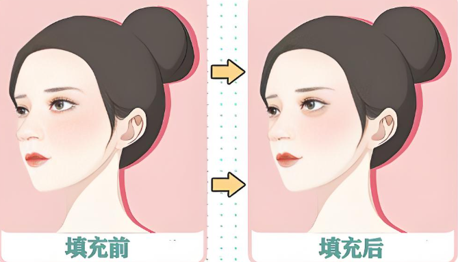 于晓雪医生执业资质与技术解析