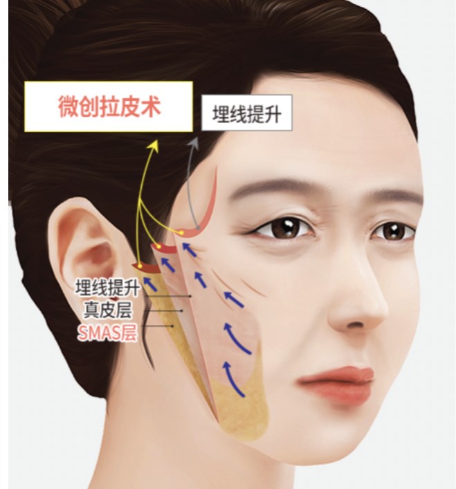 成都全辉拉皮怎么样