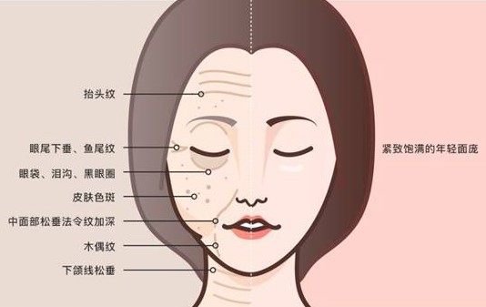 北京加减美黄寅守做拉皮要排队提前3天约