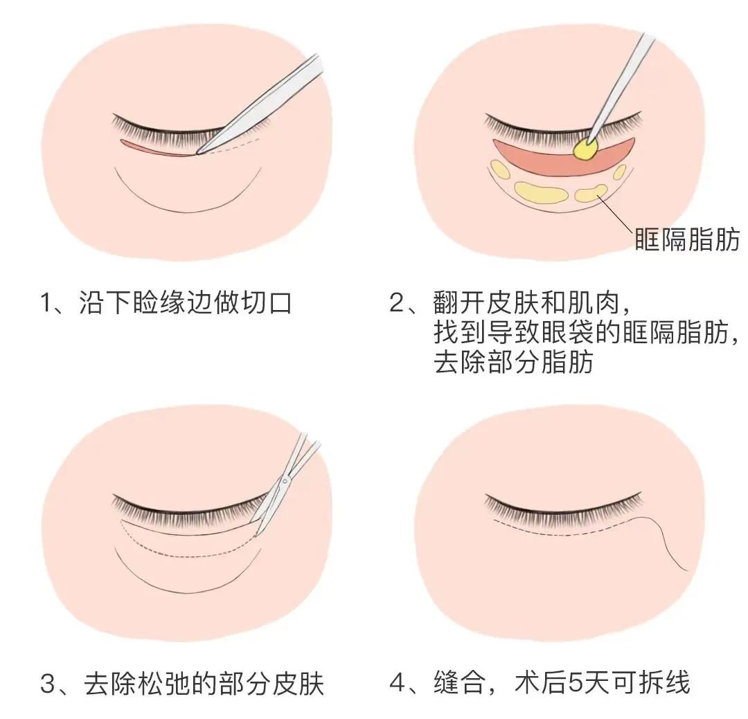 长沙爱思特麻慧菱医生就诊攻略与优惠方案