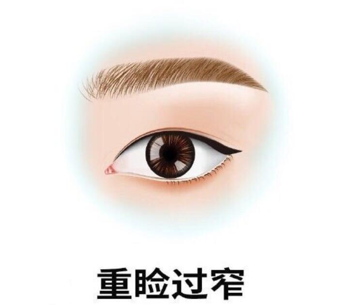 长沙爱思特麻慧菱收费贵吗?双眼皮手术价格公开,术后效果自然不夸张