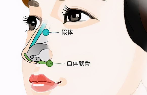 牛永敢的名气不是捧出来的