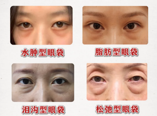 衡阳雅美医疗美容医院:进口美刀设备,怕疼星人优选