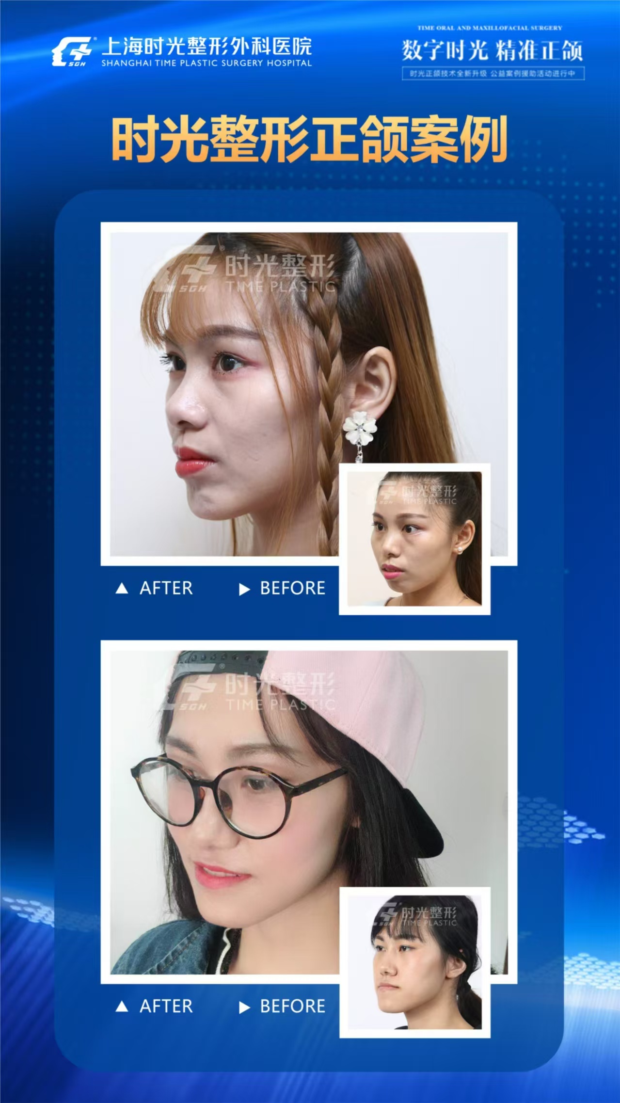 何锦泉跟艾伟健正颌哪个好?用户反馈何锦泉18年经验更懂需求,比艾伟健更贴心