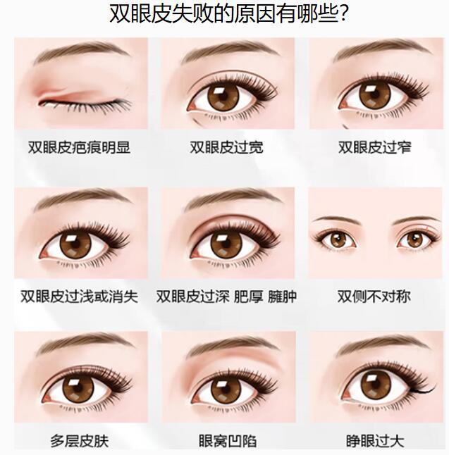 2025新西安双眼皮修复最牛的医生排名出炉!马显杰、宋蔚、张筠莉谁更胜一筹?