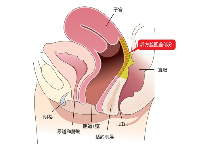 私密整形