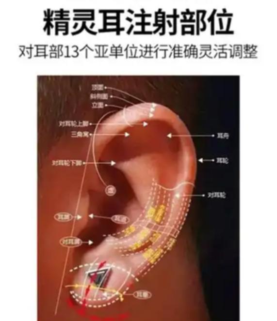 郑州精灵耳吴占飞技术怎么样