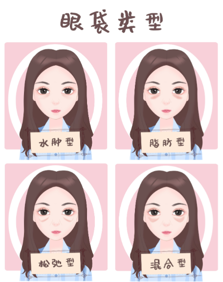 郑州眼袋修复王杨医生简介:眼周宝藏医生,3大硬核技术,眼袋修复+泪沟填充+卧蚕重塑一步到位