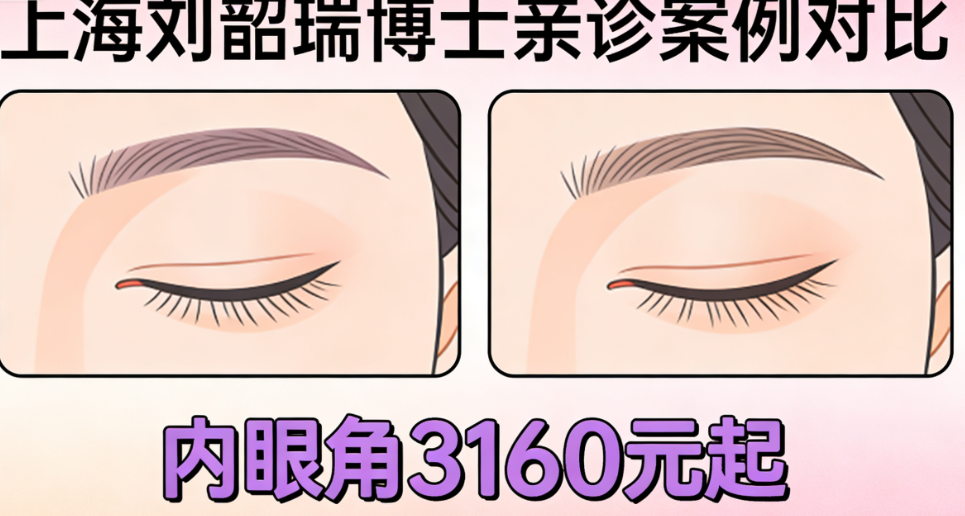 上海刘韶瑞修复内眼角技术怎么样
