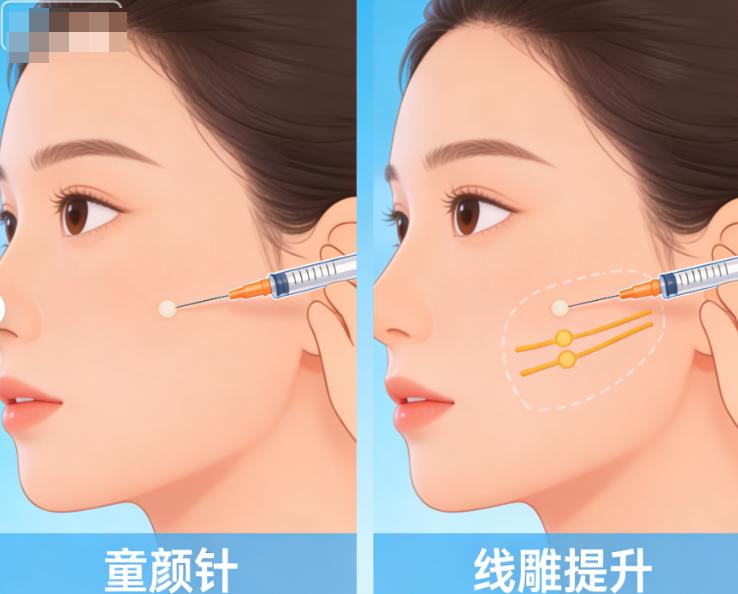何晋龙和何锦泉正颌谁厉害一点?各有所长,何晋龙复杂双颌更擅长,何锦泉微创正颌更出色