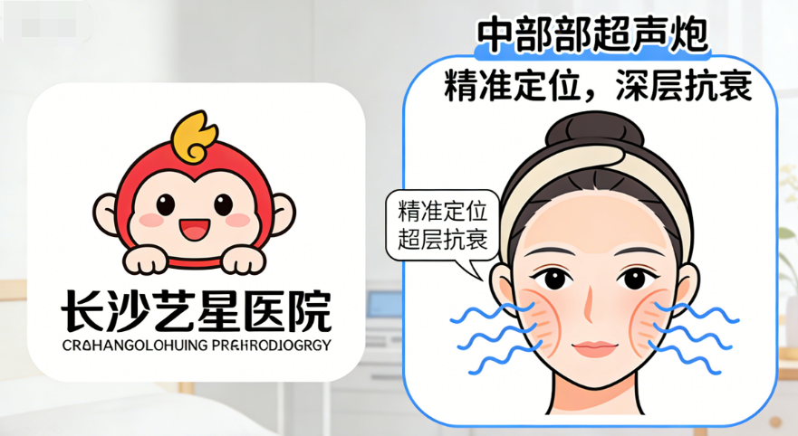 湖南哪里做中面部超声炮