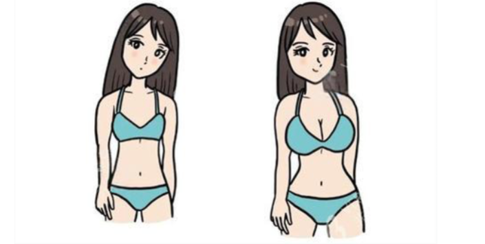 曼托水滴假体255cc术后3个月变好疗效