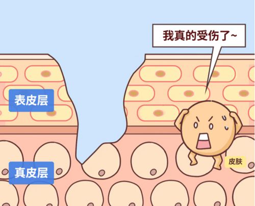 苏州祛疤痕手术治疗费用多少?2026价格表曝光,增生疤痕8000元起