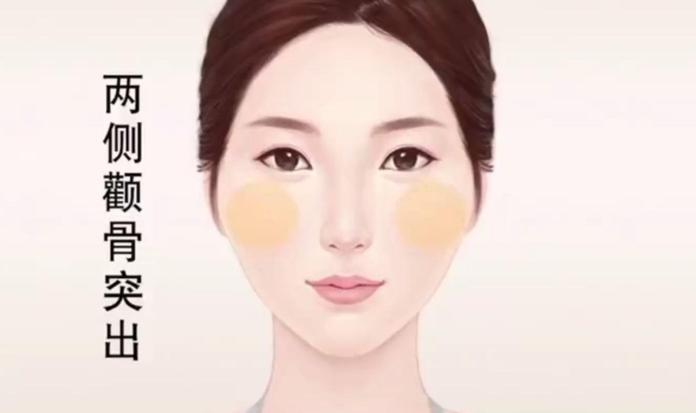 四、张笑天磨骨术后真实评价www.dlren.com
