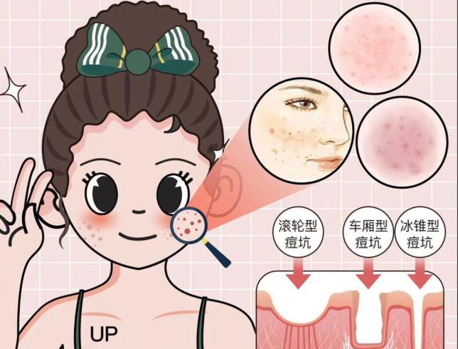 三、脂肪移植手术的注意事项与风险
