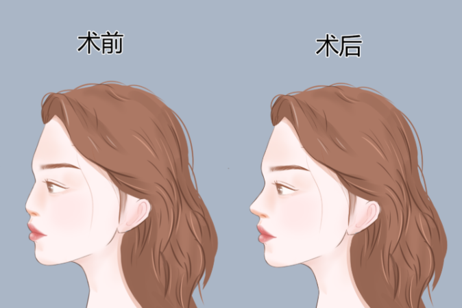 张承武医生擅长什么?聚焦眼部与鼻部的精细化整形