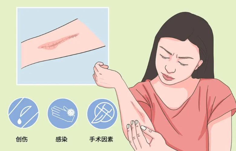 上海健桥医院疤痕科