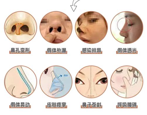 二、珠海鼻修复医院技术对比www.dlren.com