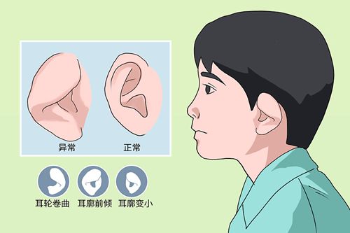 章庆国和郭树忠谁做耳朵好