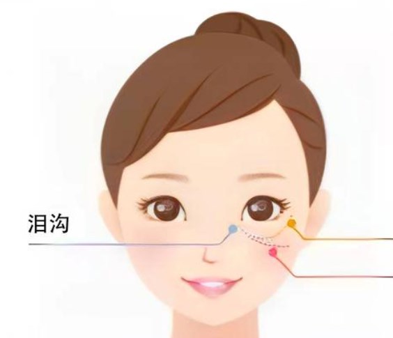 二、米兰柏羽眼袋手术技术特点分析www.dlren.com