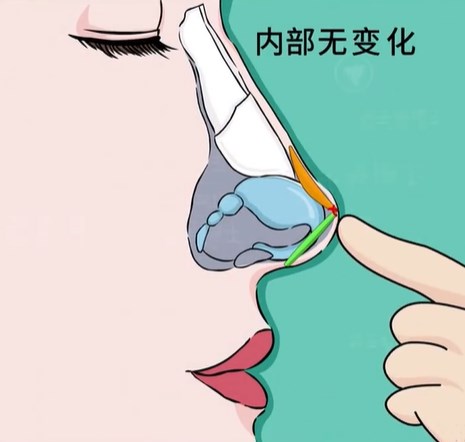 汤勇