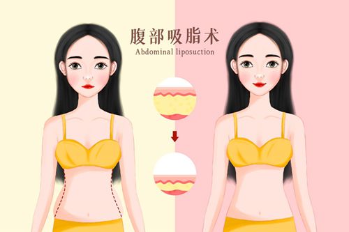 深圳脂肪整形医生对比