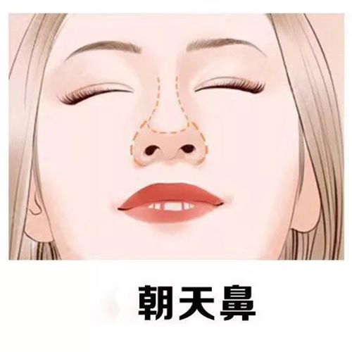 全国鼻修复大佬一次说 10 个名单来了!2025 真实榜单:向宏伟、巫文云、刘彦军、李信锋等全上榜!