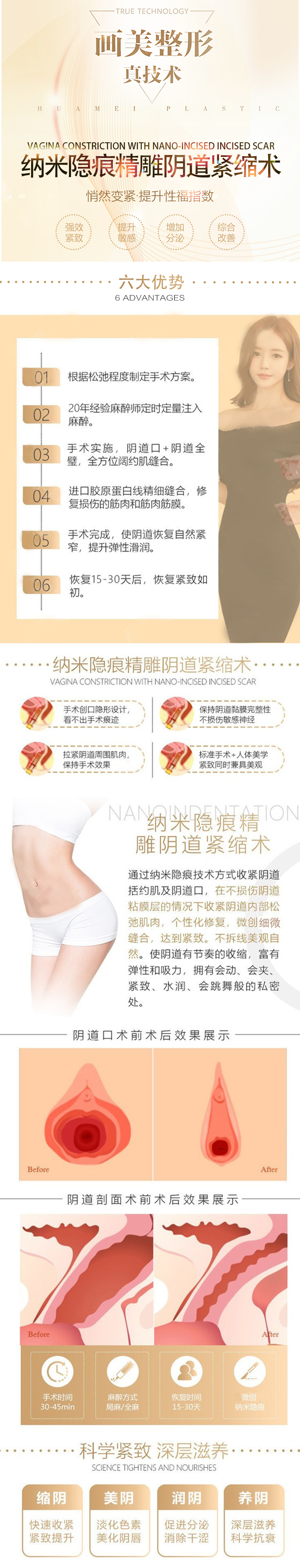 李挺