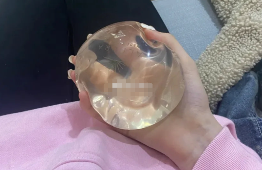 三、乳房再造手术的技术细节与患者关怀www.dlren.com
