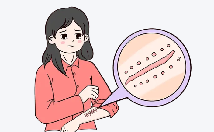 呼市疤痕修复好的医院公布,按技术靠谱度排好了!