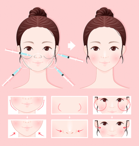 盐城熠美禾医疗美容定位:主打一个平价,但技术经得起考验