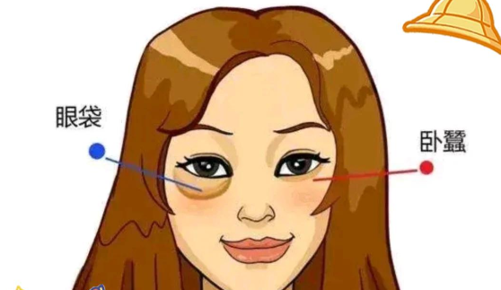 自体脂肪可以填充卧蚕吗?适合哪些人?