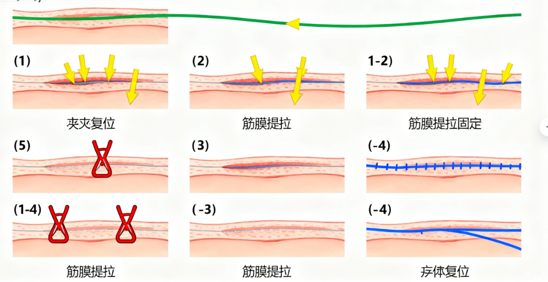 1. 术后服务:全程跟进,有问必答