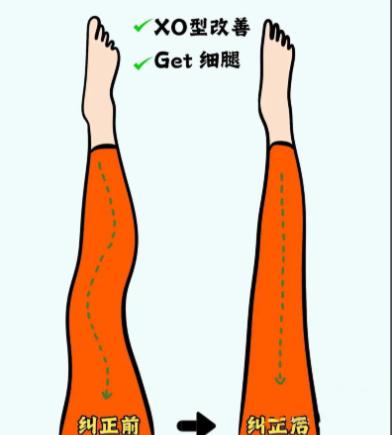 上海丽质卢九宁医生怎么联系？3种预约方式+直腿术案例分享，附医院地址