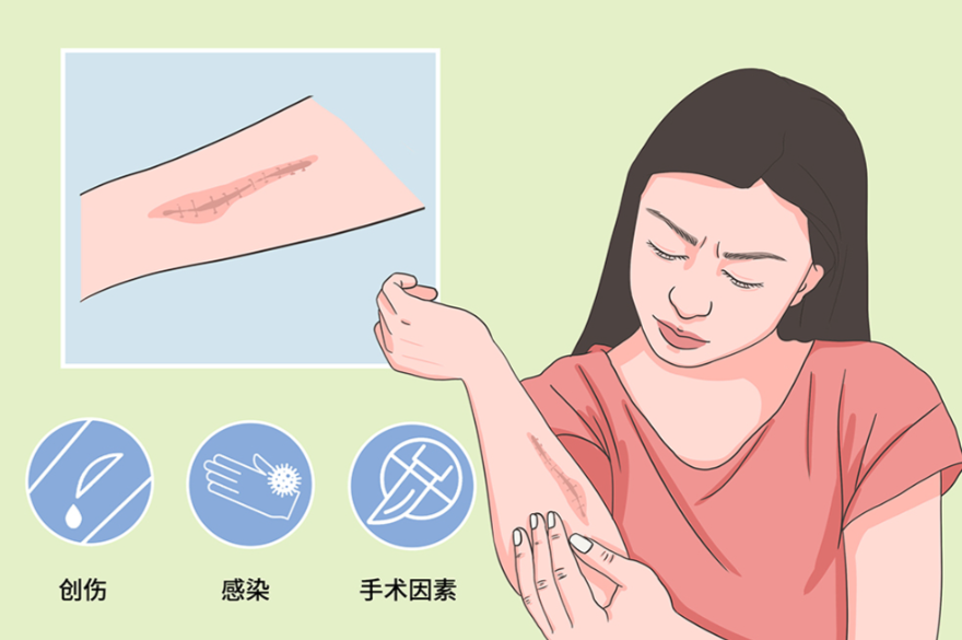 五、疤痕修复的常见问题解答