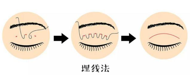 三、北京胡彬医生双眼皮就诊攻略:挂号时间、医生坐诊安排www.dlren.com
