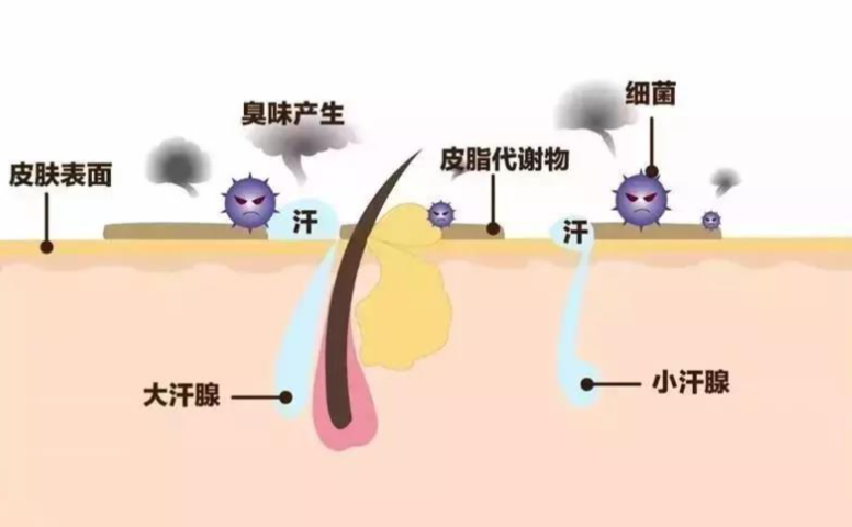三、金华去狐臭的手术多少钱 单侧vs双侧的价格www.dlren.com