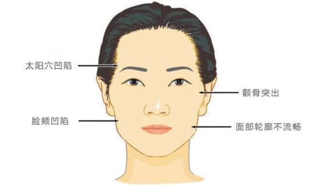 三、北京美莱田鹏医生抽脂就诊全流程指南
