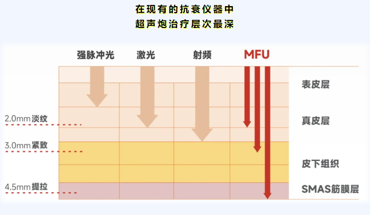 关于哈尔滨超声炮认证医生有哪些,用户较常问的几个问题(FAQ)