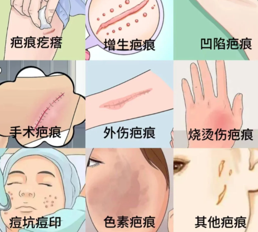 武汉疤痕修复就诊攻略：如何选择适合自己的医院？