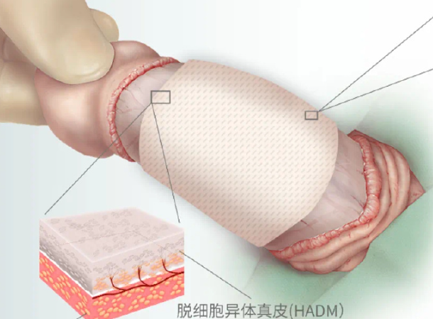 四、问答板块：你想知道的上海德琳男性私密整形都在这里www.dlren.com