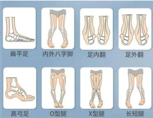 2. 审美风格:追求自然的“原生直”www.dlren.com