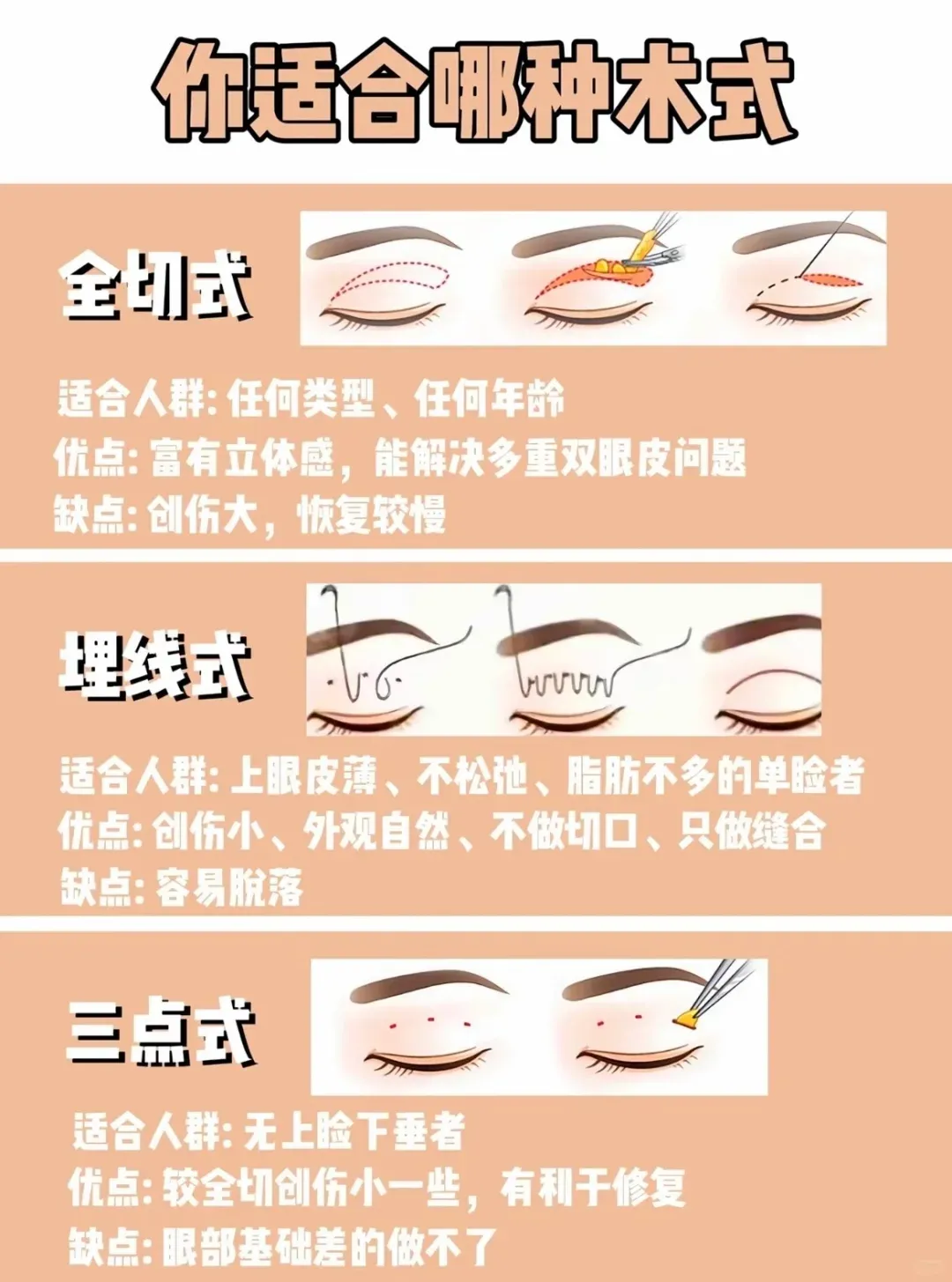 三、 想要预约成都高亮医生双眼皮,这份避坑攻略请收好