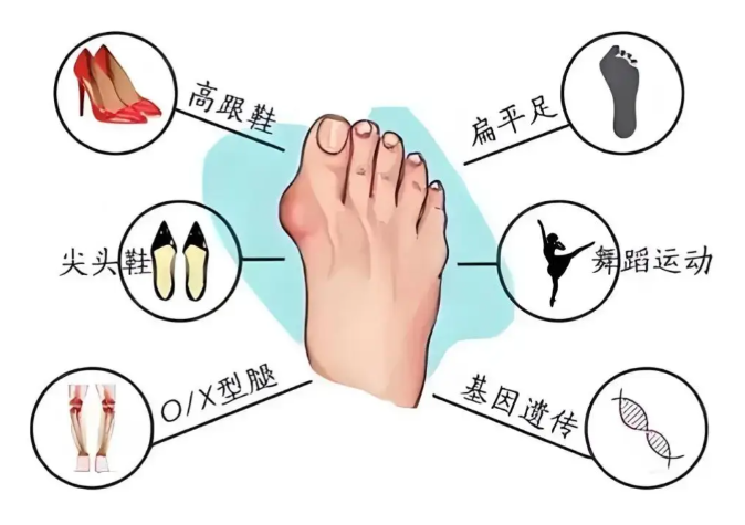 三、 徐州/北京诊疗计价闭环：如何锁定耿兴田拇外翻手术中的“封顶预算”？